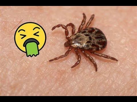 Keep Ticks & Fleas From Crawling UP Your LEGS! Prepper Survival Tips Tricks